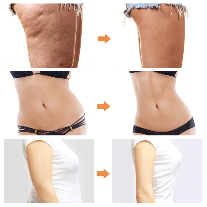 Liposuction Machine VE Sport Body Belly